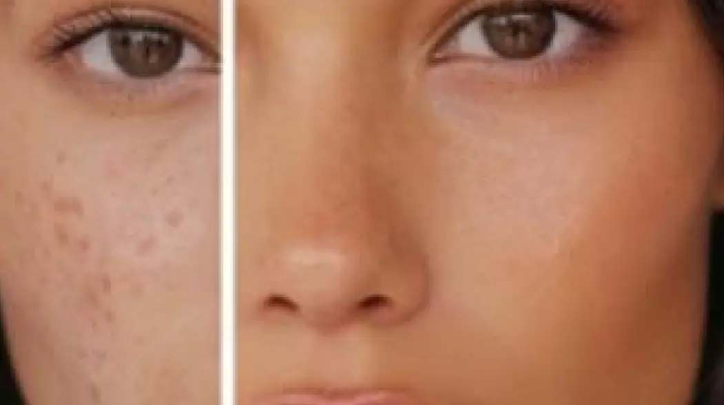 Face editor